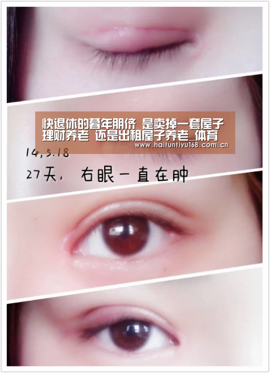 体育赛事